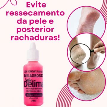 Kit para Tratamento de Pés Ressecados e Rachados: 1 Creme Dupé + 2 Loção Delima Milagroso